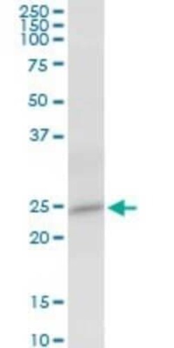 HSPC111 Antibody, Novus Biologicals 0.05 mg | Buy Online | Novus Biologicals | Fisher Scientific