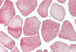 HUCE1 Antibody, Novus Biologicals 100 &mu;L; Unconjugated:Antibodies, Polyclonal
