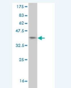 HUNK Antibody (1C4), Novus Biologicals 0.05 mg | Buy Online | Novus Biologicals | Fisher Scientific