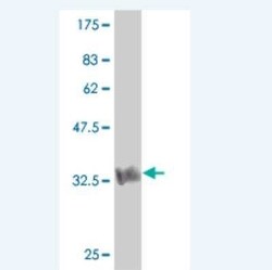 HUNK Antibody (1E4), Novus Biologicals 0.1 mg | Buy Online | Novus Biologicals | Fisher Scientific