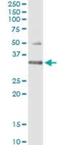 HUS1 Antibody (2B12), Novus Biologicals 0.1 mg | Buy Online | Novus Biologicals | Fisher Scientific