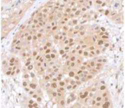 HUWE1 Antibody (BLR129H), Novus Biologicals 100 &mu;g; Unconjugated:Antibodies,