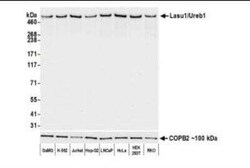 HUWE1 Antibody (BLR129H), Novus Biologicals 100 &mu;g; Unconjugated:Antibodies,