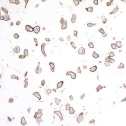 HVEM/TNFRSF14 Antibody (BLR062G), Novus Biologicals 100 &mu;g | Buy Online | Novus Biologicals | Fisher Scientific