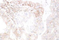 HVEM/TNFRSF14 Antibody (BLR062G), Novus Biologicals 100 &mu;g | Buy Online | Novus Biologicals | Fisher Scientific
