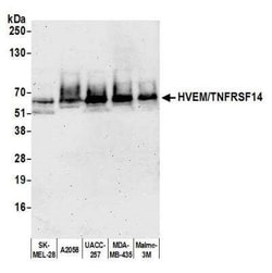 HVEM/TNFRSF14 Antibody (BLR062G), Novus Biologicals 100 &mu;g | Buy Online | Novus Biologicals | Fisher Scientific