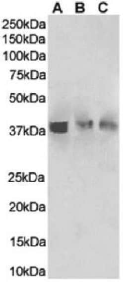 HVEM/TNFRSF14 Antibody (HMHV-1B18) - Chimeric - Azide and BSA Free, Novus