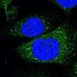 HVEM/TNFRSF14 Antibody, Novus Biologicals 25 &mu;L; Unconjugated:Anticorps,