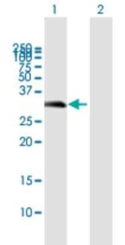 HVSL1 Antibody, Novus Biologicals 0.05 mg | Buy Online | Novus Biologicals | Fisher Scientific