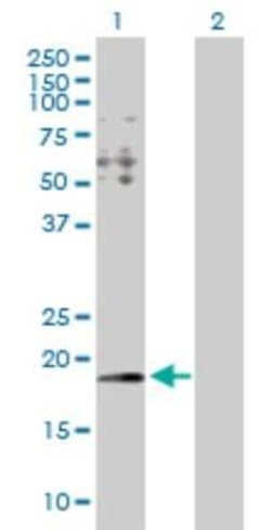 HYI Antibody, Novus Biologicals 0.1 mg; Unconjugated:Antibodies, Polyclonal