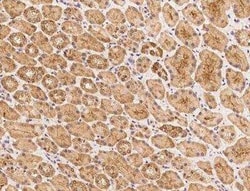 HYLS1 Antibody, Novus Biologicals 100 &mu;g; Unconjugated:Antibodies, Polyclonal