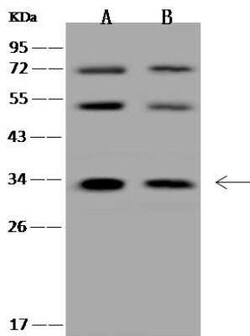 HYLS1 Antibody, Novus Biologicals 100 &mu;g; Unconjugated:Antibodies, Polyclonal