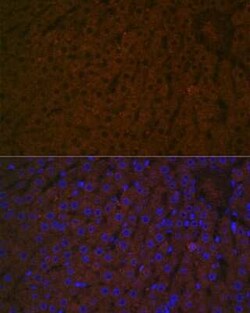 Haptoglobin Rabbit anti-Human, Mouse, Rat, Clone: 7C1N2, Novus Biologicals 100 &mu;g | Buy Online | Novus Biologicals | Fisher Scientific