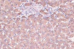 Haptoglobin Rabbit anti-Human, Mouse, Rat, Clone: 7C1N2, Novus Biologicals 100 &mu;g | Buy Online | Novus Biologicals | Fisher Scientific