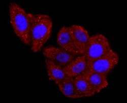 Haptoglobin Rabbit anti-Human, Clone: JM10-79, Novus Biologicals 100 &mu;L | Buy Online | R&D Systems | Fisher Scientific