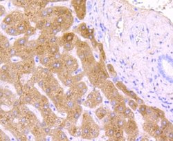 Haptoglobin Rabbit anti-Human, Clone: JM10-79, Novus Biologicals 100 &mu;L | Buy Online | R&D Systems | Fisher Scientific