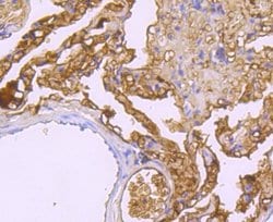 Haptoglobin Rabbit anti-Human, Clone: JM10-79, Novus Biologicals 100 &mu;L | Buy Online | R&D Systems | Fisher Scientific