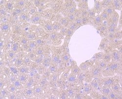 Haptoglobin Rabbit anti-Human, Clone: JM10-79, Novus Biologicals 100 &mu;L | Buy Online | R&D Systems | Fisher Scientific