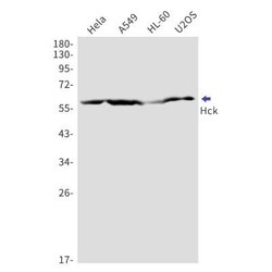 Hck Rabbit anti-Human, Clone: S02-5C1, Novus Biologicals 25 &mu;g | Buy Online | Novus Biologicals | Fisher Scientific