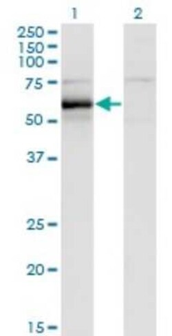 Hck Antibody (1D9-1A9), Novus Biologicals 0.1 mg | Buy Online | Novus Biologicals | Fisher Scientific