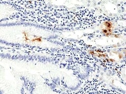 Helicobacter Pylori Rabbit anti-Bacteria, Clone: RM429, Novus Biologicals:Antibodies:Primary