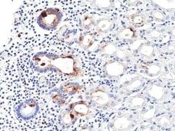 Helicobacter Pylori Rabbit anti-Bacteria, Clone: RM429, Novus Biologicals:Antibodies:Primary