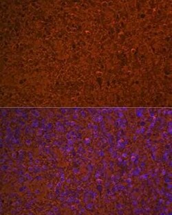 Hemoglobin A1 Rabbit anti-Human, Mouse, Rat, Clone: 1R1N7, Novus Biologicals