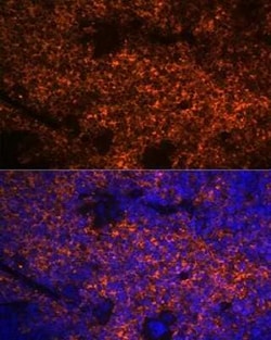 Hemoglobin A1 Rabbit anti-Human, Mouse, Rat, Clone: 1R1N7, Novus Biologicals