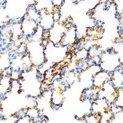 Hemoglobin A1 Rabbit anti-Human, Mouse, Rat, Clone: 1R1N7, Novus Biologicals