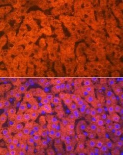 Hemopexin Rabbit anti-Human, Mouse, Rat, Clone: 1M6O3, Novus Biologicals