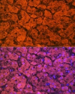 Hemopexin Rabbit anti-Human, Mouse, Rat, Clone: 1M6O3, Novus Biologicals