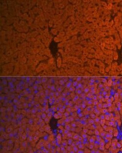 Hemopexin Rabbit anti-Human, Mouse, Rat, Clone: 1M6O3, Novus Biologicals