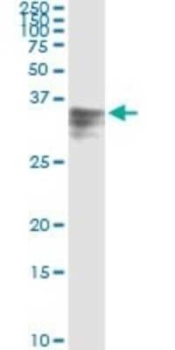Hemopexin Antibody (3A9-1A9), Novus Biologicals 0.1 mg | Buy Online | Novus Biologicals | Fisher Scientific