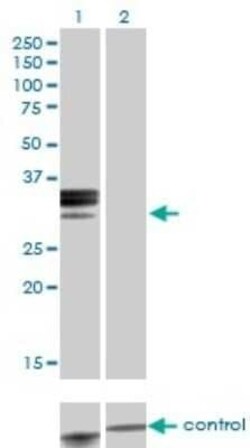 Hemopexin Antibody (3A9-1A9), Novus Biologicals 0.1 mg | Buy Online | Novus Biologicals | Fisher Scientific