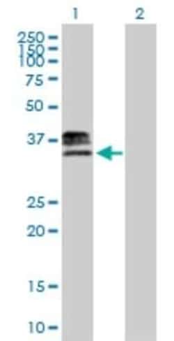 Heparan Sulfate 3-O-Sulfotransferase 1/HS3ST1 Antibody, Novus Biologicals 0.05 mg | Buy Online | Novus Biologicals | Fisher Scientific