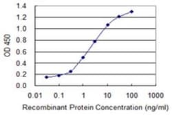 Heparan Sulfate 6-O-Sulfotransferase 1/HS6ST1 Antibody (1G4), Novus Biologicals 0.1 mg | Buy Online | Novus Biologicals | Fisher Scientific