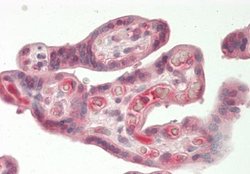 Heparanase/HPSE Rabbit anti-Human, Polyclonal, Novus Biologicals 0.1 mL | Buy Online | Novus Biologicals | Fisher Scientific