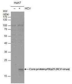 Hepatitis C Virus Core Antigen Antibody, Novus Biologicals 100 μg; Unconjugated:Antibodies,