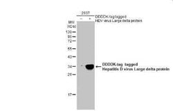 Hepatitis D Virus Large Delta Antibody, Novus Biologicals 100 &mu;g | Buy Online | Novus Biologicals | Fisher Scientific