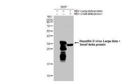 Hepatitis D Virus Large/Small Delta Antibody, Novus Biologicals 100 &mu;g | Buy Online | Novus Biologicals | Fisher Scientific