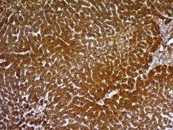 Hepatocyte Specific Antigen Antibody (HepPar1), Novus Biologicals 0.02mg;