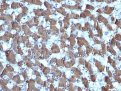 Hepatocyte Specific Antigen Antibody (HepPar1), Novus Biologicals 0.02mg;