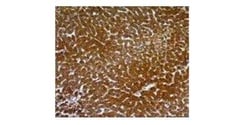 Hepatocyte Specific Antigen Antibody (SPM582), Novus Biologicals 0.02 mg;