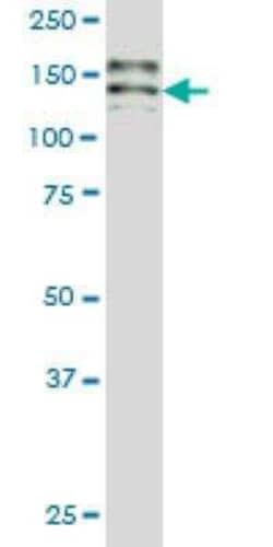 Hephaestin Antibody (2D3), Novus Biologicals 0.1 mg | Buy Online | Novus Biologicals | Fisher Scientific