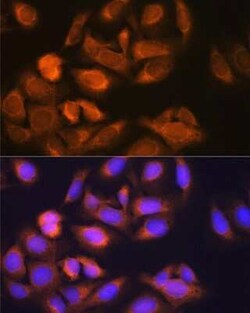 Hexokinase 1 Rabbit anti-Human, Mouse, Rat, Clone: 6B7Q2, Novus Biologicals 20 &mu;g | Buy Online | Novus Biologicals | Fisher Scientific