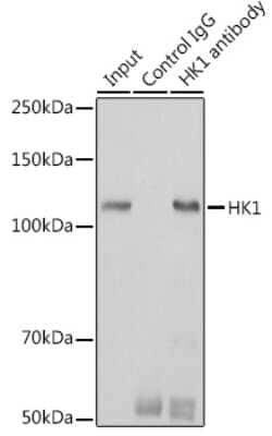 Hexokinase 1 Rabbit anti-Human, Mouse, Rat, Clone: 6B7Q2, Novus Biologicals 20 &mu;g | Buy Online | Novus Biologicals | Fisher Scientific