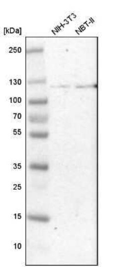 Hexokinase 1 Antibody, Novus Biologicals 25 &mu;L; Unconjugated:Antibodies,
