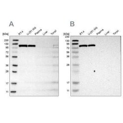 Hexokinase 1 Antibody, Novus Biologicals 25 &mu;L; Unconjugated:Antibodies,