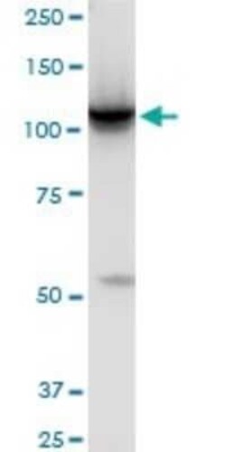Hexokinase 2 Antibody (4H1), Novus Biologicals 0.1 mg, Unconjugated:Antibodies,