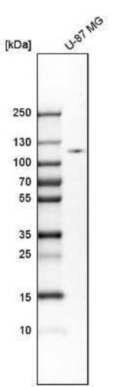 Hexokinase 2 Antibody, Novus Biologicals 25 &mu;L | Buy Online | Novus Biologicals | Fisher Scientific